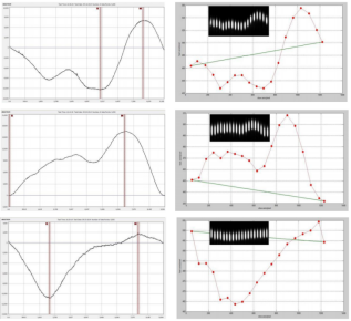 台阶仪测量 Smile 形态（左）与光学方法测量 Smile 形态（右）对比